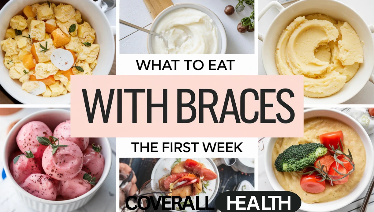 What to Eat with Braces the First Week