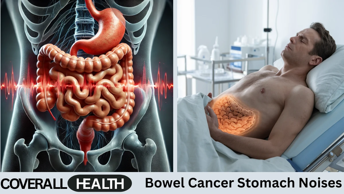 Bowel Cancer Stomach Noises