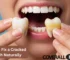 How to Fix a Cracked Tooth Naturally